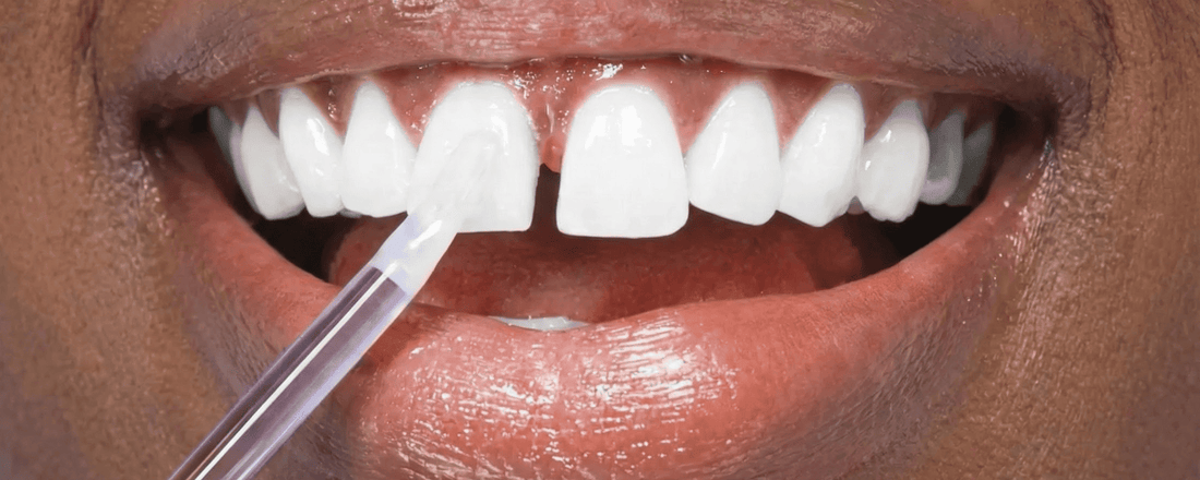 Penna Sbiancante Denti PAP+: La Rivoluzione Portatile per un Sorriso Bianco Ovunque Tu Sia