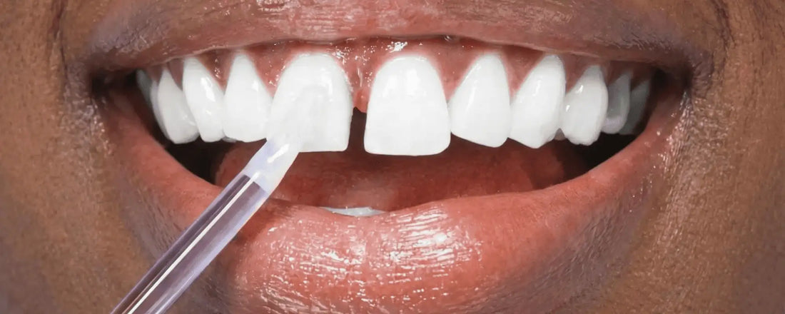 Penna Sbiancante Denti PAP+: La Rivoluzione Portatile per un Sorriso Bianco Ovunque Tu Sia