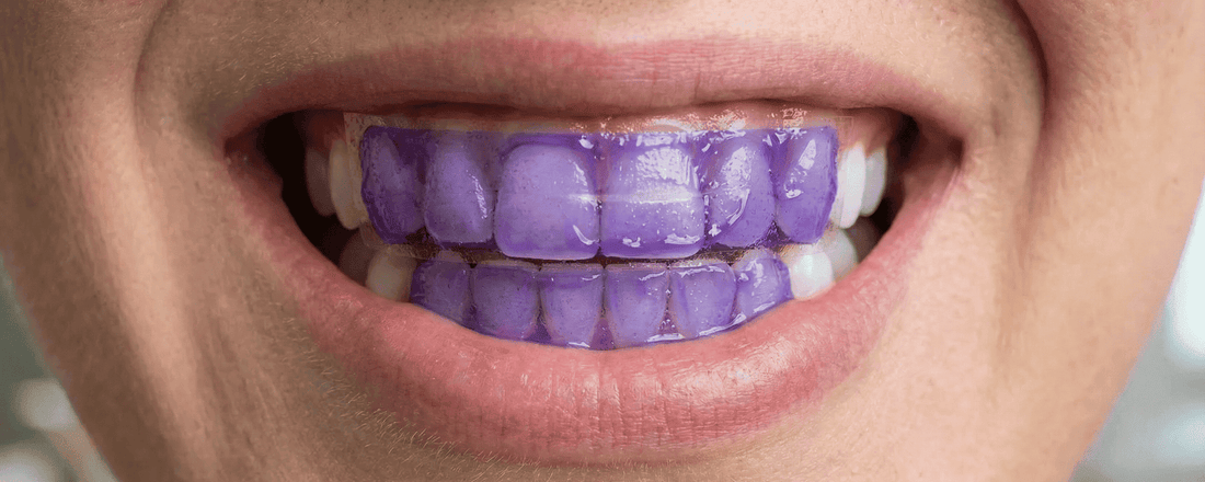 Strisce Sbiancanti Viola Purple: Guida Completa e Recensioni 2026