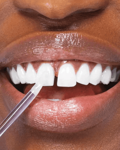 GlorySmile®  WhitePen Pro