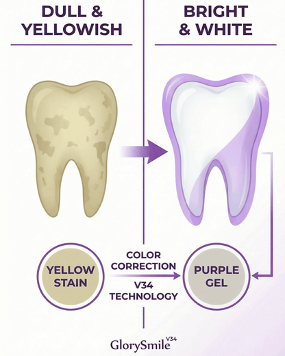 GlorySmile® MintStrips V34